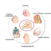 Par de Corretor Protetor de Joanete Terapia Magnética Alívio de Dores nos Pés e Dedão